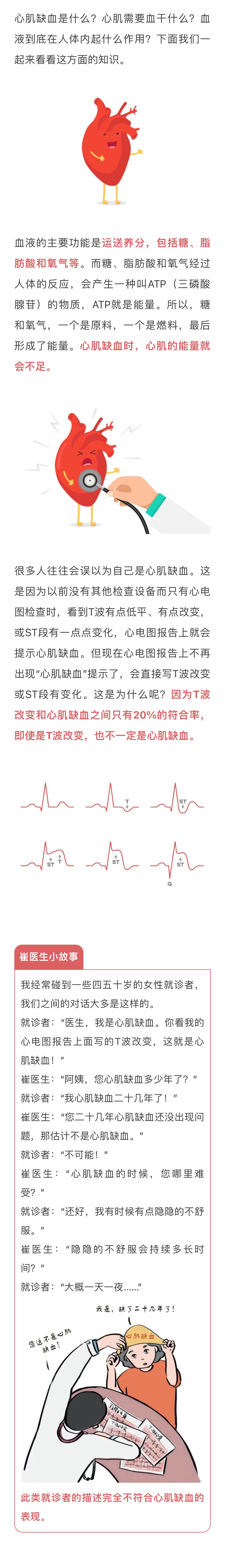 动静健康t波改变就是心肌缺血吗到底要不要紧答案看这里