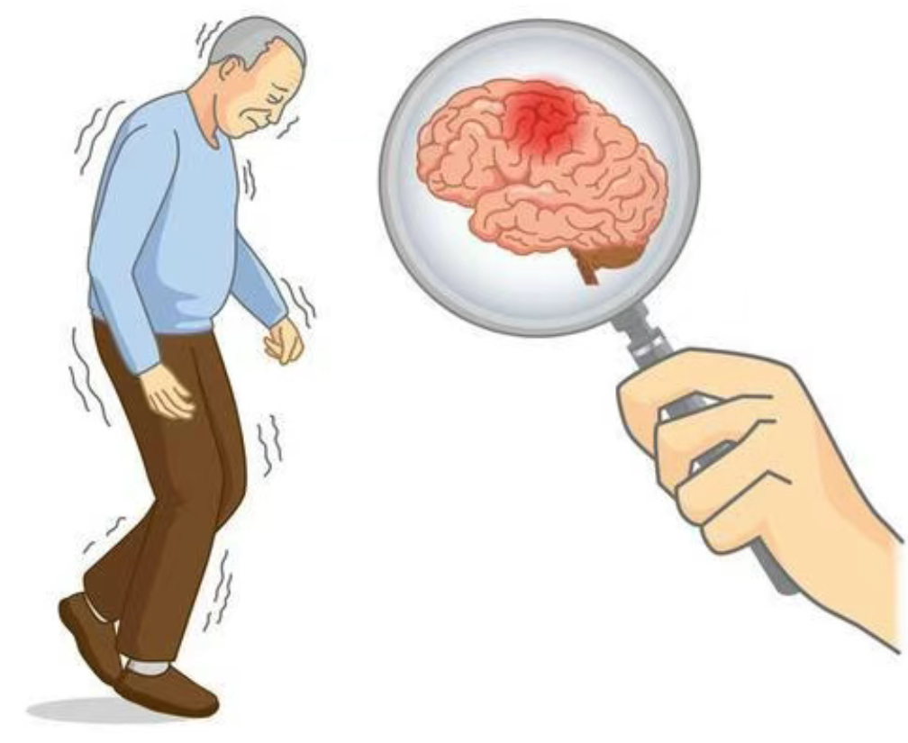 动静健康头晕右侧肢体无力是怎么回事