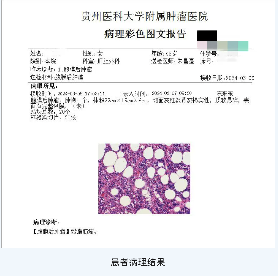 科室动态腹围渐长误以为是中年发福医生检查后直冒冷