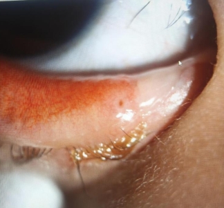 431f3bf25bb6d11fc8352037ffaa08b8_compress