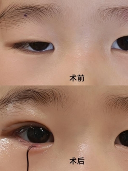 076f50fdbb174c88e8a246cadad0a66e