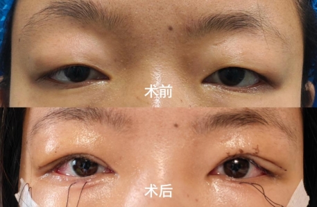 91354f3d791c206b0b5d478dcb4205fe