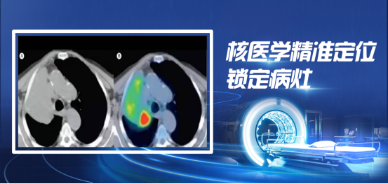 精准定位